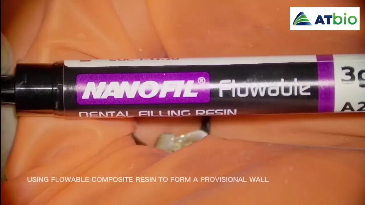 NANOFIL | Flowable Light-Cured Composite Resin |  Dental Filling Resin Clinical Procedure