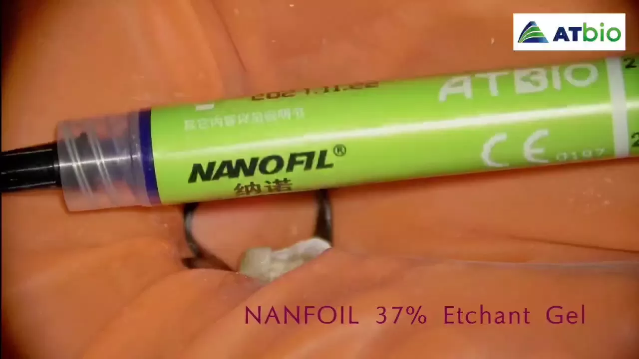 NANOFIL | Etchant Gel Dental Phosphoric Acid | Clinical Applications
